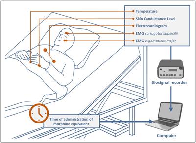 The impact of analgesic on EMG and other biosignals in a postoperative setting